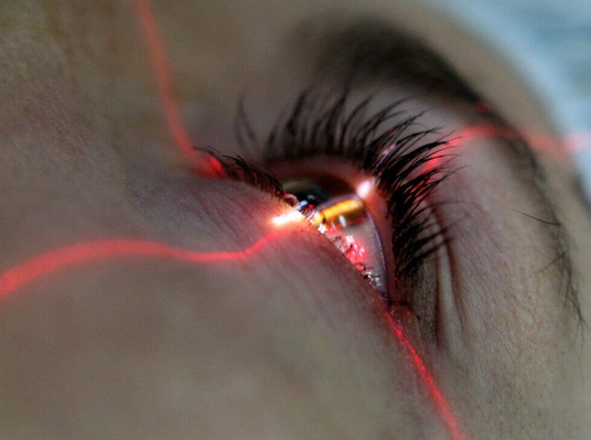 Курс лазерная коррекция зрения