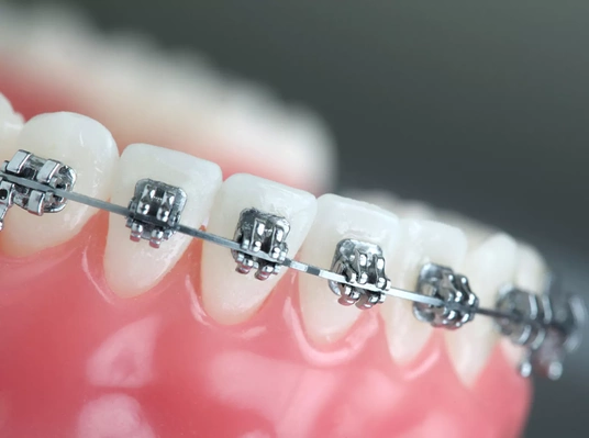 Курс ортодонтия: актуальные вопросы и инновационные решения