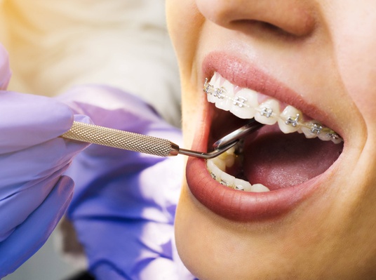 Курс ортодонтия